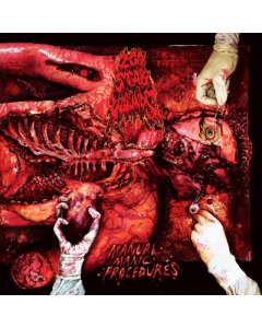 200 STAB WOUNDS - MANUAL MANIC PROCEDURES (DISFIGURED FACE VINYL)