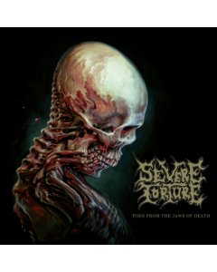 SEVERE TORTURE - TORN FROM THE JAWS OF DEATH