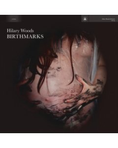 WOODS,HILARY - BIRTHMARKS