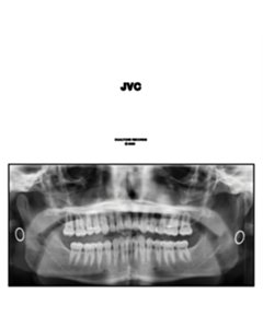 Jvc (2Lp) - Jack Van Cleaf