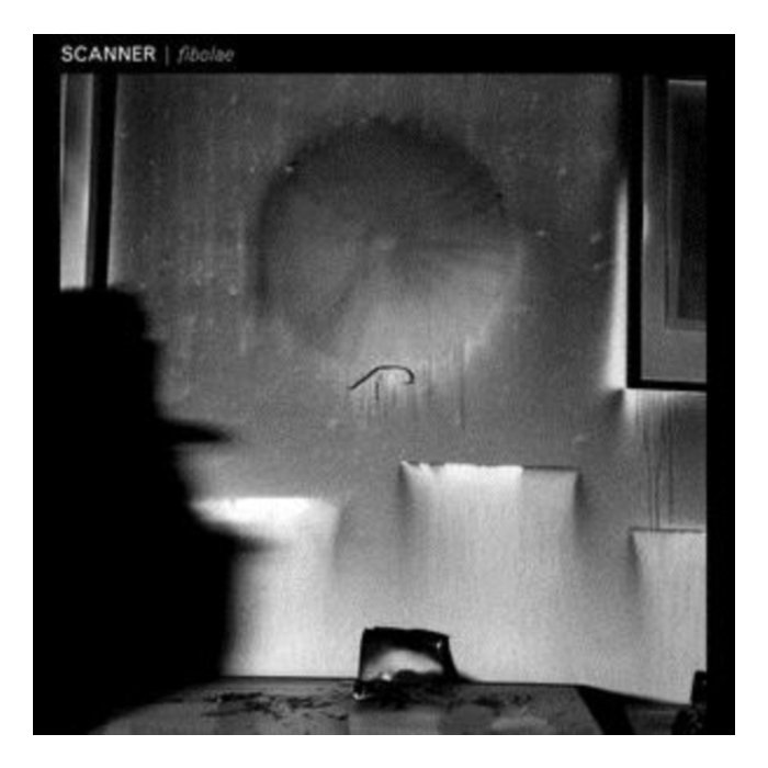 SCANNER - FIBOLAE