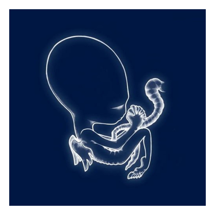 SIGUR ROS - AGAETIS BYRJUN