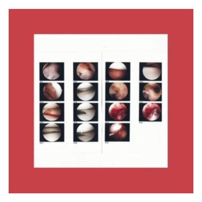 CRADLE - LAUGHING IN MY SLEEP (DL CARD)