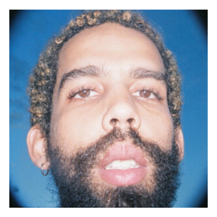 No Reino Dos Afetos (Blues Vinyl) - Berle,Bruno